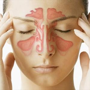 Sinus Sign - Herbal Treatment For Sinus - How Sinus Can Be Treated With Herbs