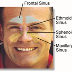 Bacterial Sinusitis Antibiotics - Signs Of Sinus Infection