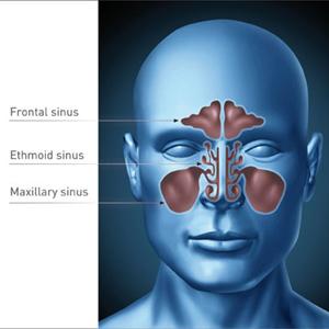  Sinusitis Medication