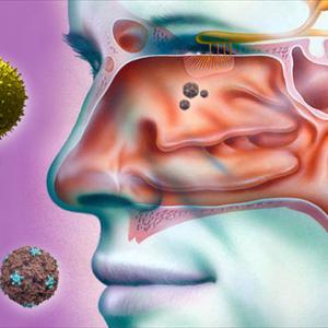 Picture Of Sinusitis - Sinus Infection And Dizziness Symptoms 