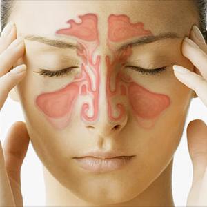 Blood Eyes Sinusitis - Telltale Signs Of A Sinusitis Pressure Headache