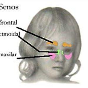 Sinus Genie - Sinusitis And Antibiotics Do Not Go Hand In Hand All The Time